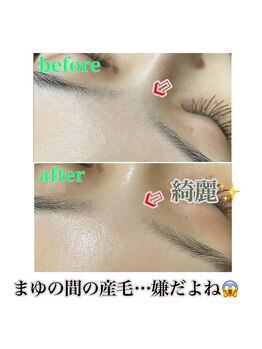 ナチュウル(Natulu)/シルク糸脱毛＊眉の間も綺麗に★