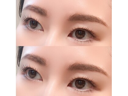ブライト(bright)の写真