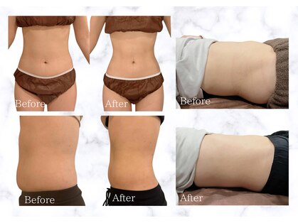 フラットベリー 恵比寿(Flat BELLY)の写真