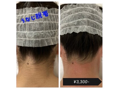 ワクシングサロン ツィター(Waxing salon zither)の写真