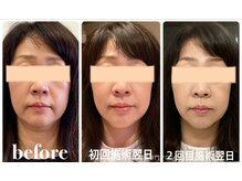 クリーム 京都店(Cream)/