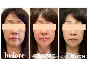 クリーム 京都店(Cream)/