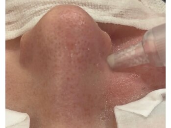 エムズ(emus.)/毛穴皮脂管理しませんか