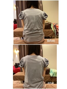 ヴィラ整骨院/肩の高さの違いの改善に◎