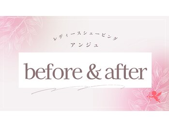 アンジュ/Before&After