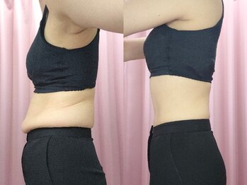 美容整体カラダリメイク(karada)/骨盤矯正ダイエットの結果