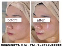エムイーボーテ(me.Beaute)の雰囲気（ぜひご自身のお肌で変化を体感してみてください！）