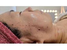 クレビア(CREBIA)/【シミ・シミケア専門店】沖縄県