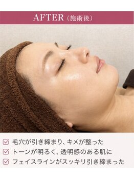 山参/ＡＦＴＥＲ