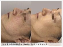 サロン ド ボーテ シャルル(Chaleureux)の雰囲気（【30年来の赤み敏感さ、くすみ】ご自宅ケアで、睡眠の質向上も。）