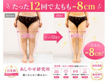 メディカルエステ 大宮店/※痩身症例写真※ 痩身/痩身