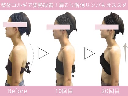 小顔フェイスラボ 那覇店(小顔 Face Labo.)の写真