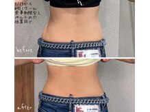 ウィート(WHeAT)の雰囲気（皆さま結果が出てます◎痩身・骨盤底筋引き締め大注目マシン★）