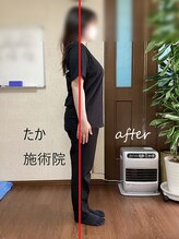 たか施術院/首 肩こり 美姿勢 3か月 施術後
