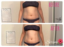 セリーヌ(serene)/キャビ×ラジ