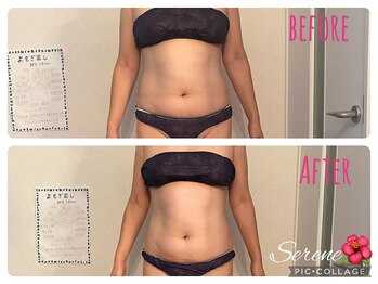 セリーヌ(serene)/キャビ×ラジ