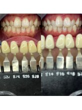 トウキョウスワーズ 池袋店(TOKYO SWRS)/#ホワイトニング #池袋 #渋谷