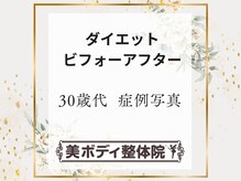 美ボディ整体院/30代でダイエットされた方々