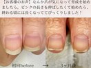 地爪育成コース【3ヵ月(全8回)】