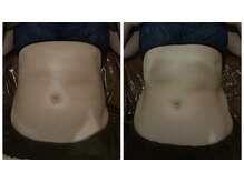 ソラウミ(SORAUMI)/気になるお腹周りにアプローチ！