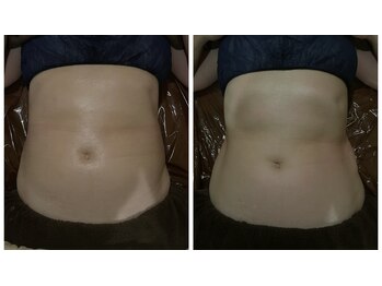 ソラウミ(SORAUMI)/気になるお腹周りにアプローチ！