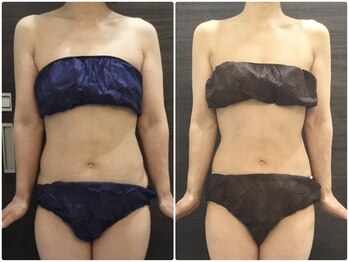 美容整体ウェリナ 名駅院/小顔矯正/骨盤矯正/美脚サロン