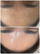 ジュエルビューティー(Jewel Beauty)/ダクトピール1回め