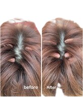 ニコディア(nico-dia)/小顔矯正