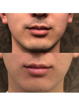 フェリーバ(FELIVA)/印象変わります