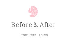 那賀洋子式 顔ジム 大分戸次店/Before＆After