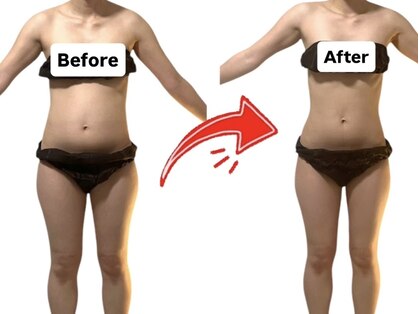 ヨサパーク アミ(YOSA PARK ami)の写真