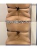 Open記念価格【浮き輪肉撃退】脂肪冷却2カップ