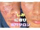 フロート(float)の写真