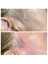 爪屋べっぴん堂/お顔のWAX