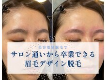エチ毛ット