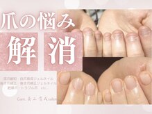 キュア(Cure.)