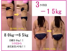 辛い食事制限や運動なくても－10キロ目指せる我慢しなくていい