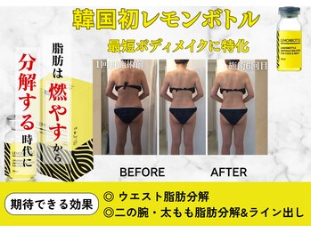 フレアージュ/レモンボトルボディビフォアフ