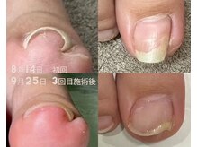 スリーナイン(3Nine)/