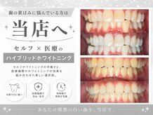ホワイトニングビューティー 金沢駅前店(WHITENING BEAUTY)