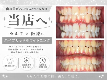 ホワイトニングビューティー 金沢駅前店(WHITENING BEAUTY)の写真