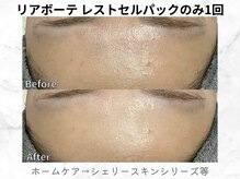 リライン(ReLine)/【レストセルパックのみ】