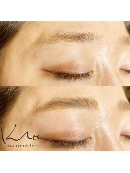 クレー(Klee)/アイブロウリフト