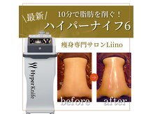 リーノ プロデュースド バイ ティービーピー(Liino Produced by TBP)