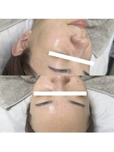 ラ フルール(La Fleur)/カーボキシートリートメント