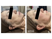 チャマ 高知店(CHAMA)/年齢問わず始められるケアを