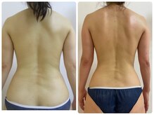 加圧ビューティーサロン スタイル エム(beauty salon style M)/40代／加圧×痩身リンパ120分