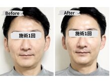 マリア(MALIA)/南森町で輪郭印象ケア