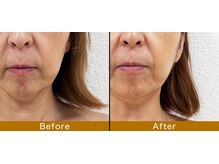 ルドゥーテ 塩釜/