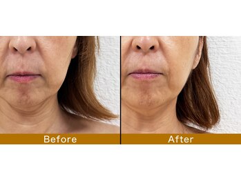 ルドゥーテ 塩釜/